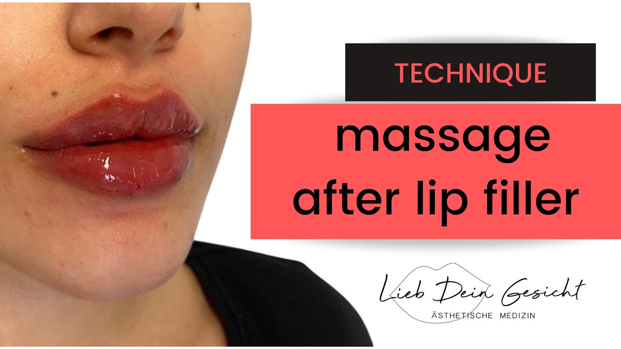 Lip Filler Massage and how to fix Bumps