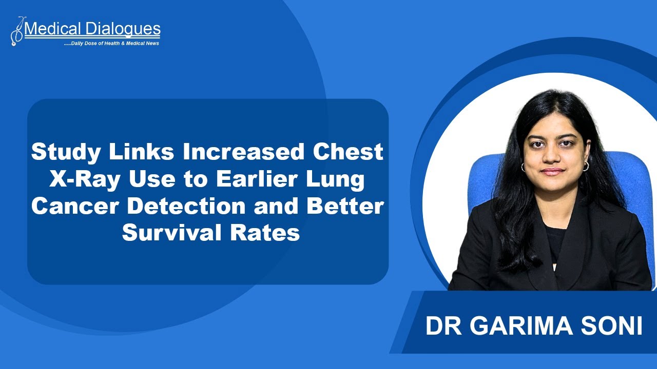 Study Links Increased Chest X-Ray Use to Earlier Lung Cancer Detection and Better Survival Rates