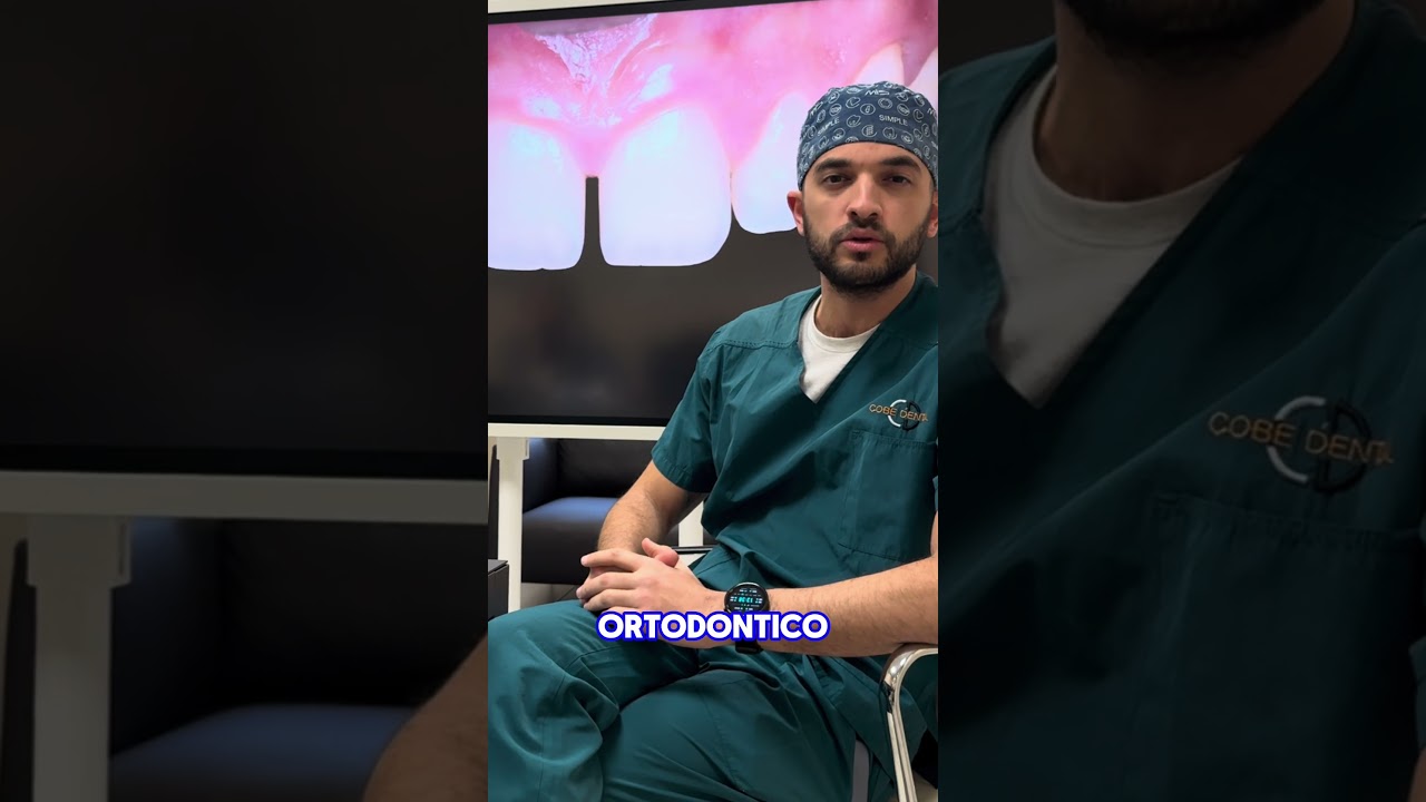 Come Chiudere Lo Spazio Tra I Denti