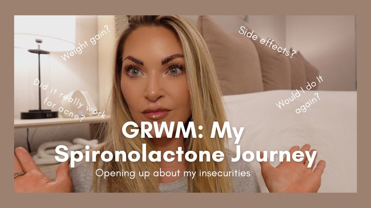 My Acne Story | The Truth About My Skin | My Journey with Spironolactone