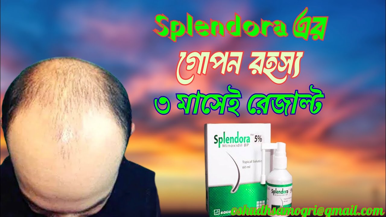 ৩ মাসেই চুল গজাবে! Splendora 5% (Minoxidil) ব্যবহারের নিয়ম জানুন #foryou #viralvideo 