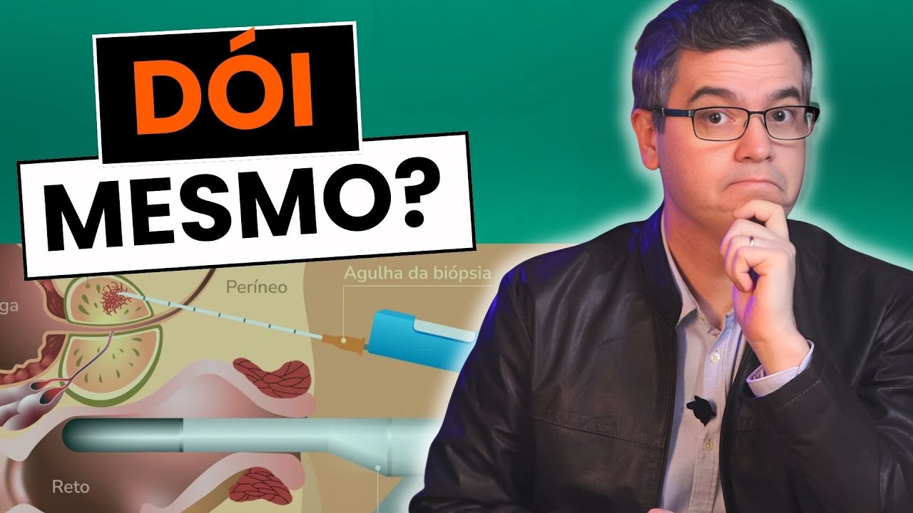 BIÓPSIA DE PRÓSTATA DÓI? PRECISA TER MEDO?  Dr Juliano Plastina