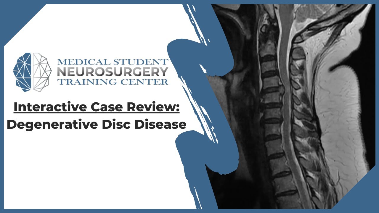 Interactive Case Review Degenerative Disc Disease