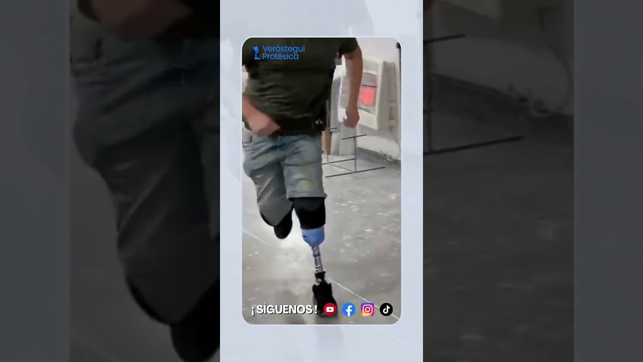 Пациент с двойной ампутацией | Verástegui Orthopedics