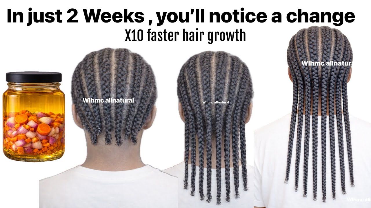 In just 2 weeks, you’ll pull your braids. Your hair might grow too fast. Try it Now