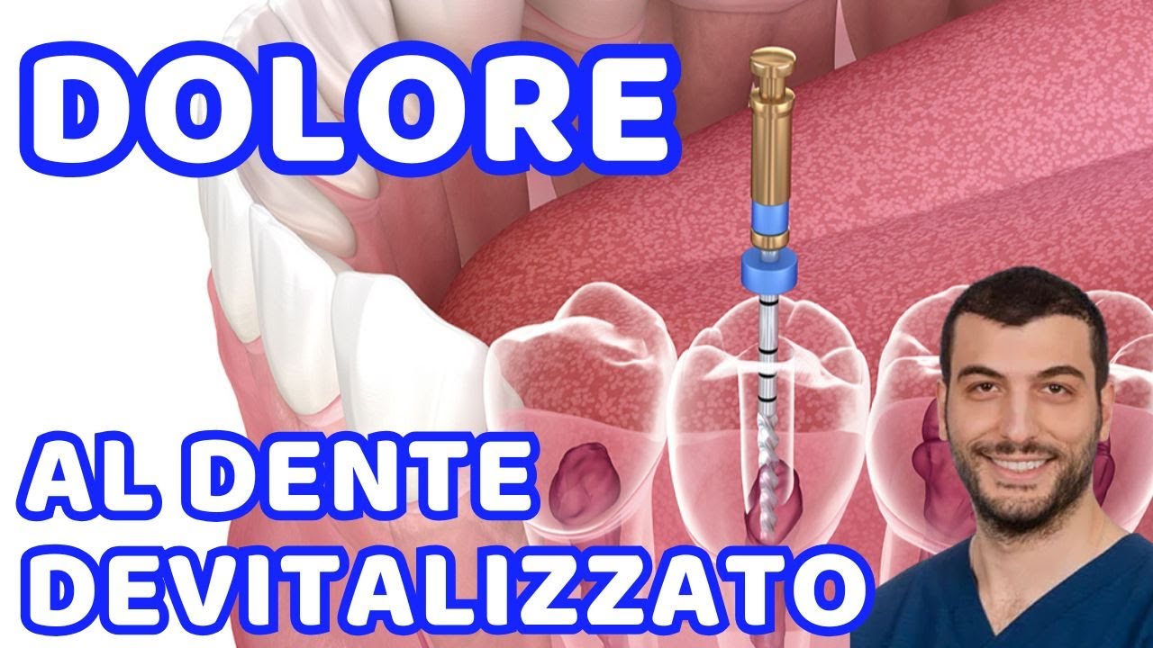 Perché il dente devitalizzato mi fa male?