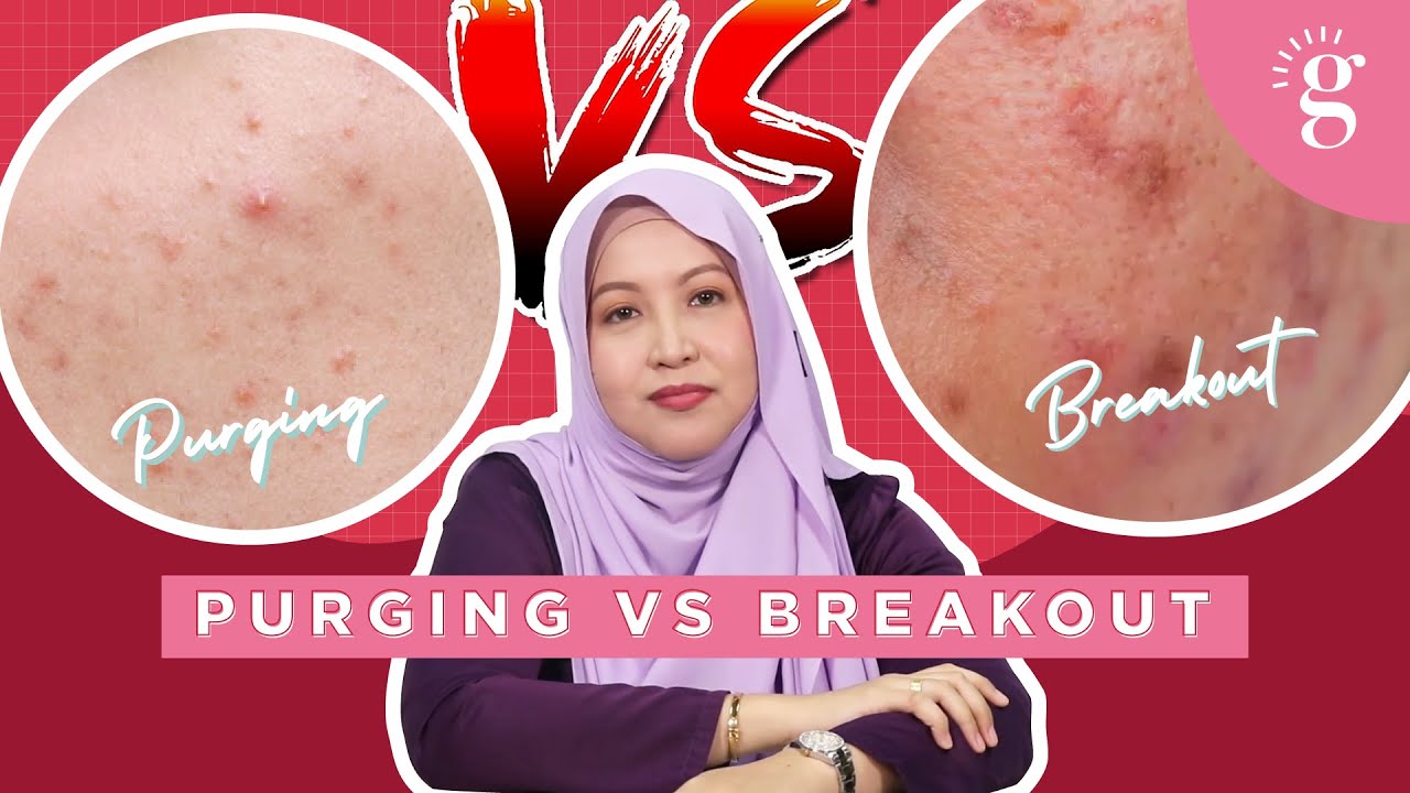 Purging vs. Breakout - Ini Perbezaan dan Cara Menghadapinya