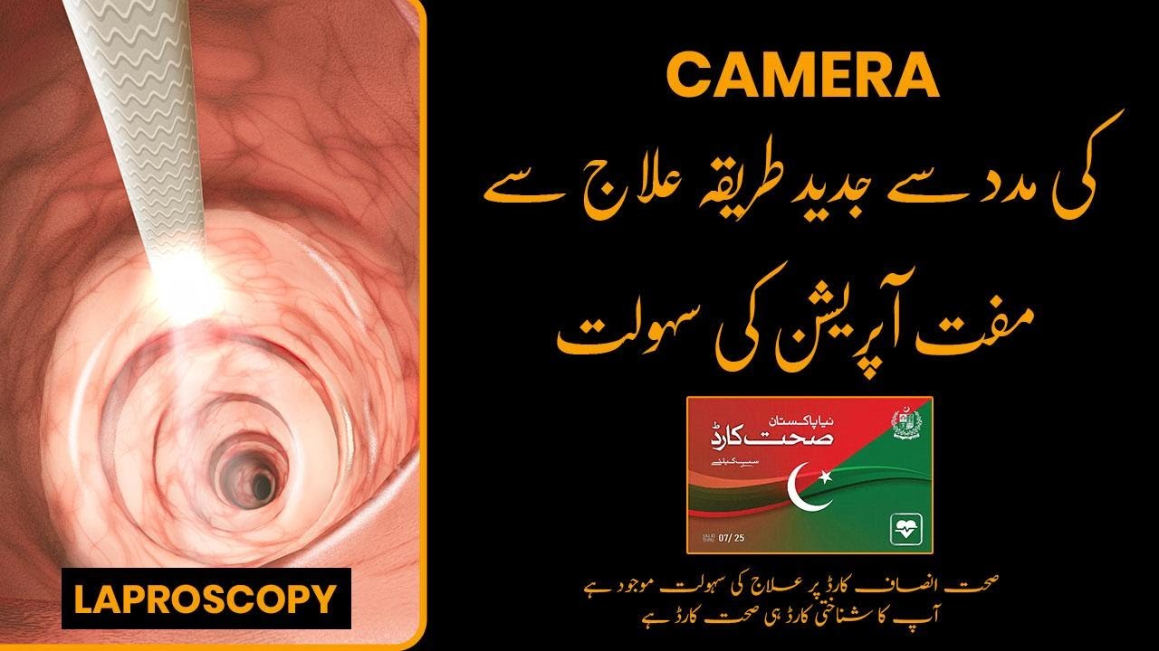 Dr Usman Imtiaz | General Surgeon | Laparoscopic Surgeon | Health Card Services | MMC Official