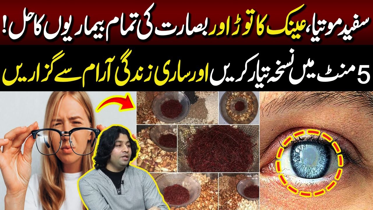 White Cataracts, Glasses & Vision Issues | A 5-Minute Solution for Lifelong Comfort | Lahore Rang