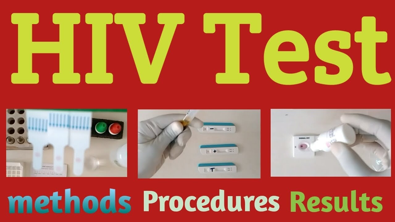 HIV Test kit Procedure in Hindi 3 Methods and Results