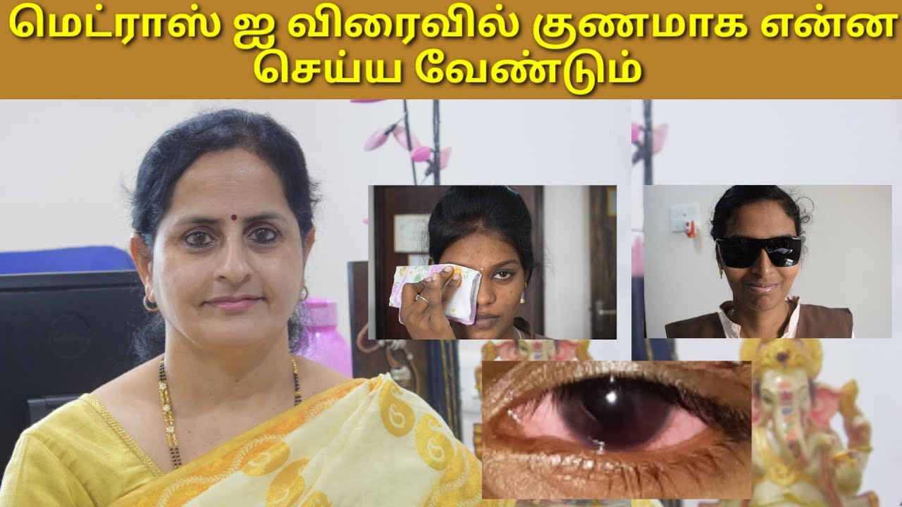 மெட்ராஸ் ஐ விரைவு சிகிச்சை