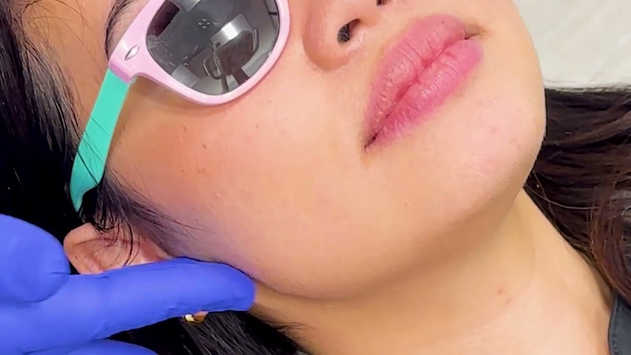Oral Cancer Screening with Dr. Sam of University District Dental