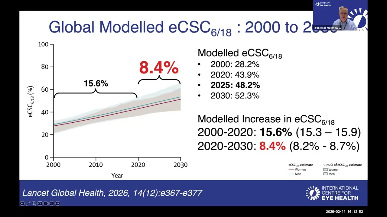 Cataract: Global Data for 2030 Webinar (4pm)