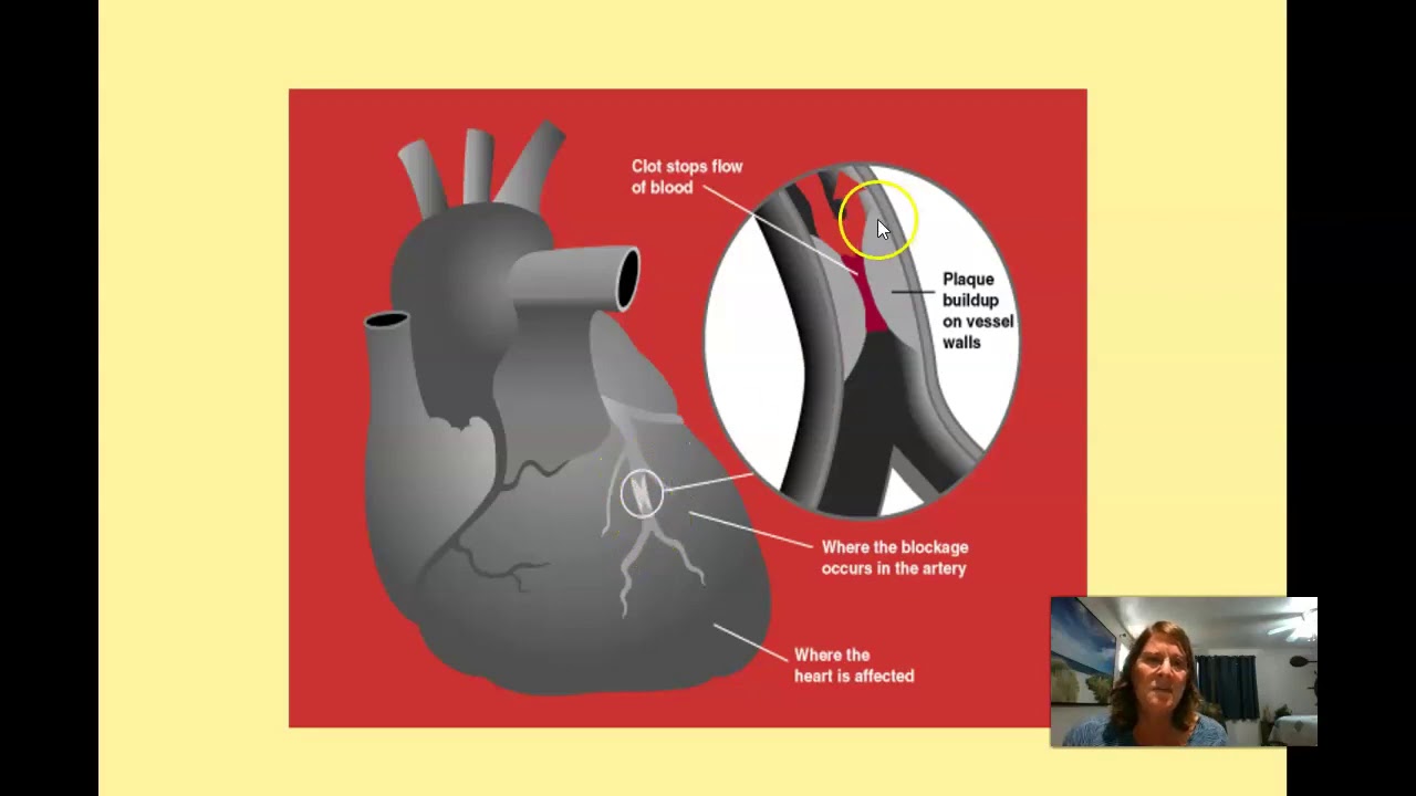 Cardiovascular and Respiratory System Disorders