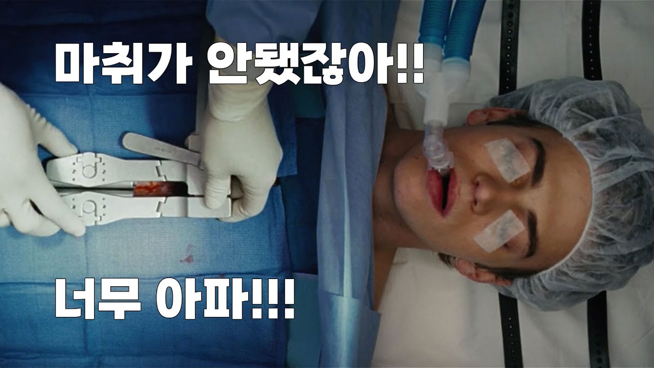[스릴러] 수술 중 모든 감각이 느껴지던 남자가 알게 된 충격적인 비밀