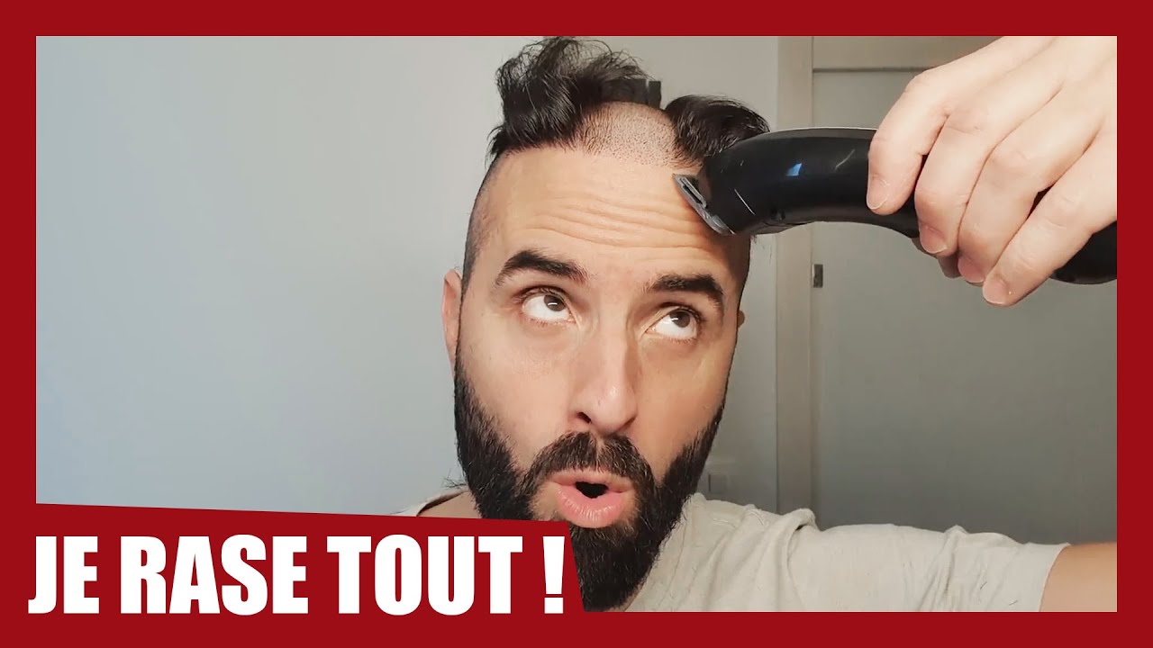 Je me rase le crâne, 1 an après mes 2 greffes de cheveux !