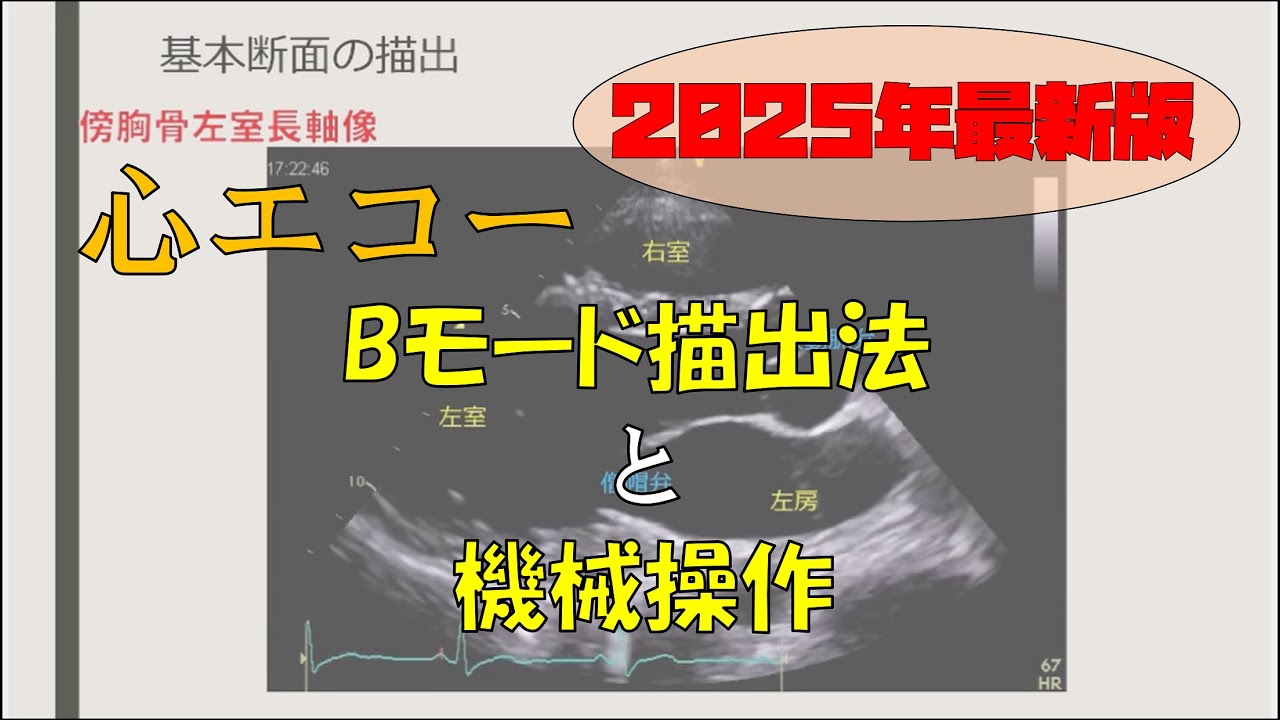 【2025年度版】Bモード描出法のコツと機械操作のポイント【心エコー】