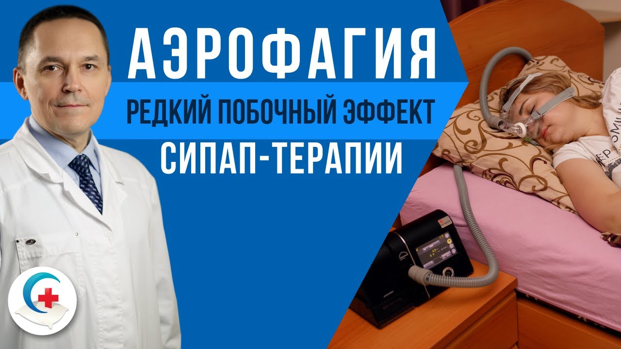 Аэрофагия (заглатывание воздуха) при СИПАП-терапии