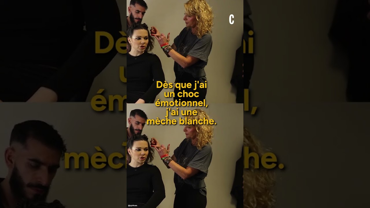 Juju Fitcats et sa m&egrave;che blanche : confidences sur le vitiligo