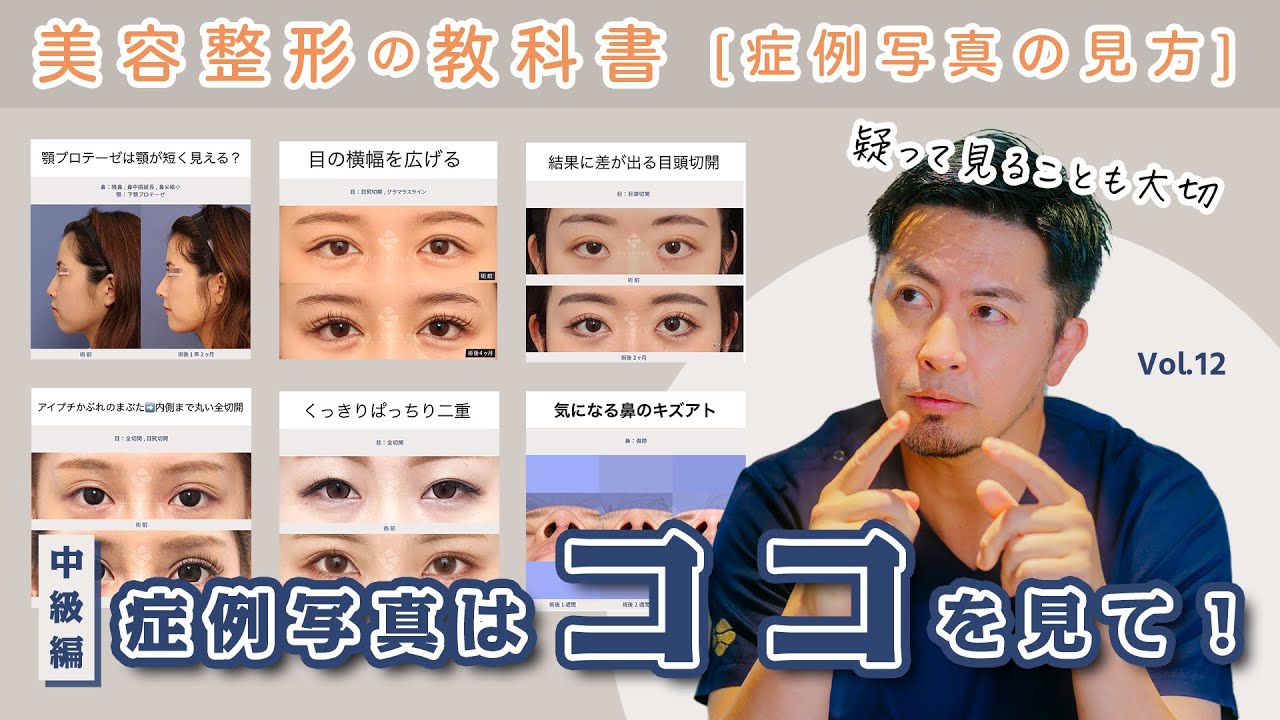 vol.12 症例写真はココを見て！ | 目尻切開/目頭切開/グラマラスライン/全切開/糸リフト/鼻中隔延長/傷跡【美容整形の教科書】