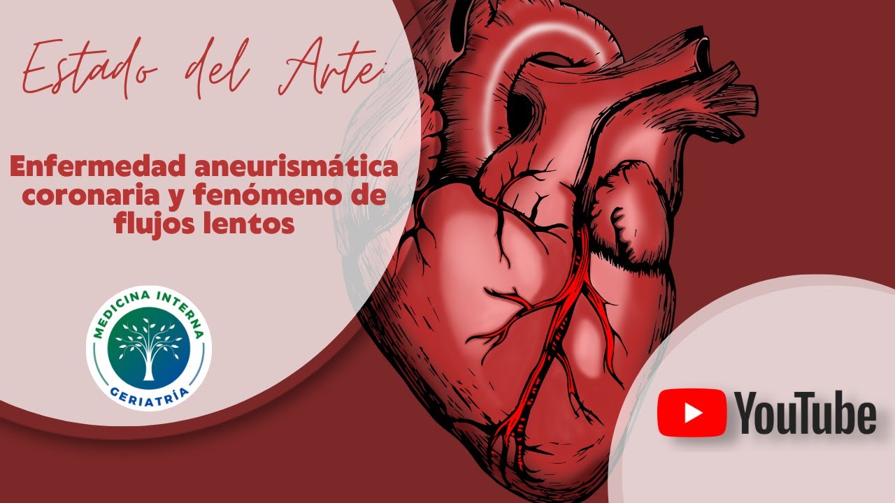 Enfermedad aneurismática y fenómeno de flujos lentos.