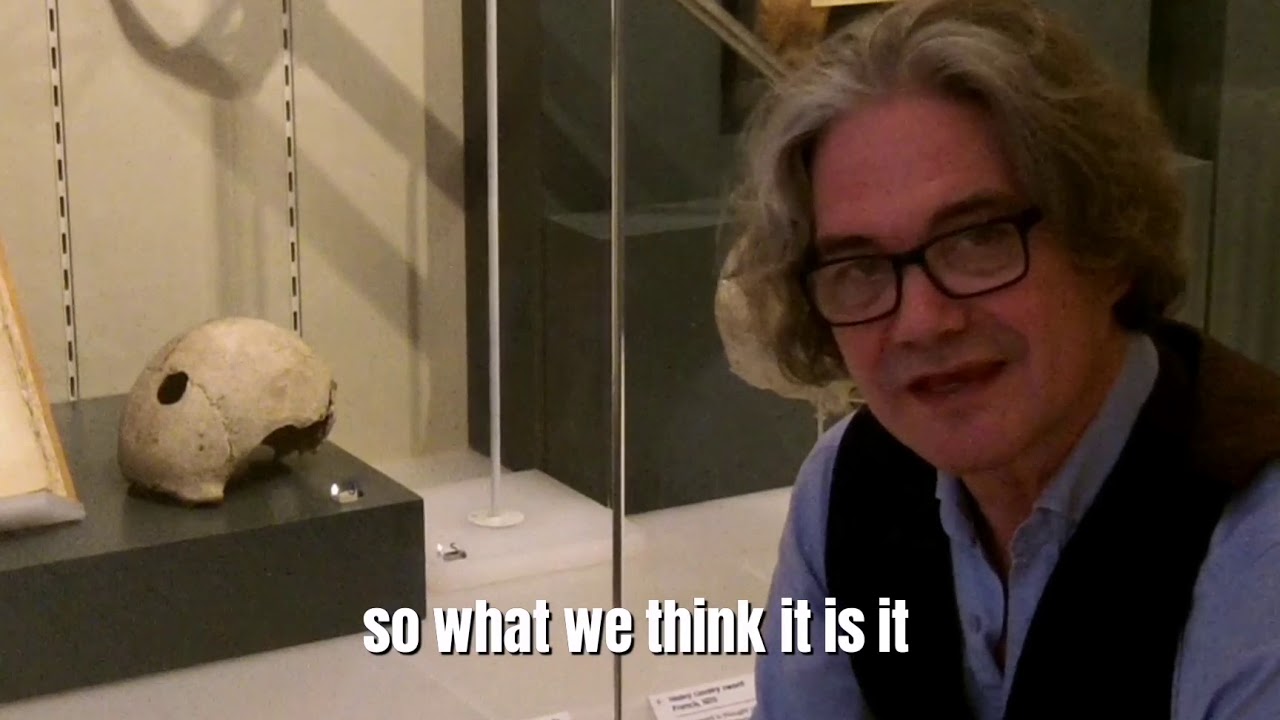 Tales from Surgeons' Hall: The Culloden Skull