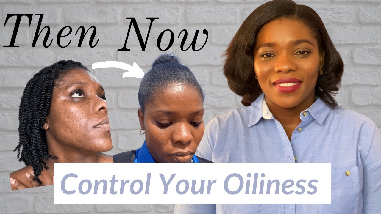 7 Skincare Tips for Oily Skin | How to control Sebum production on the face - Dr. Janet