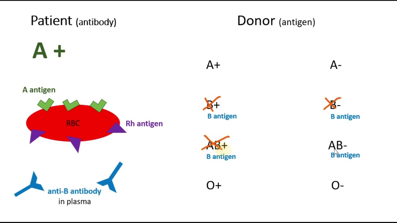 A Positive Blood Type (Donating and Receiving)