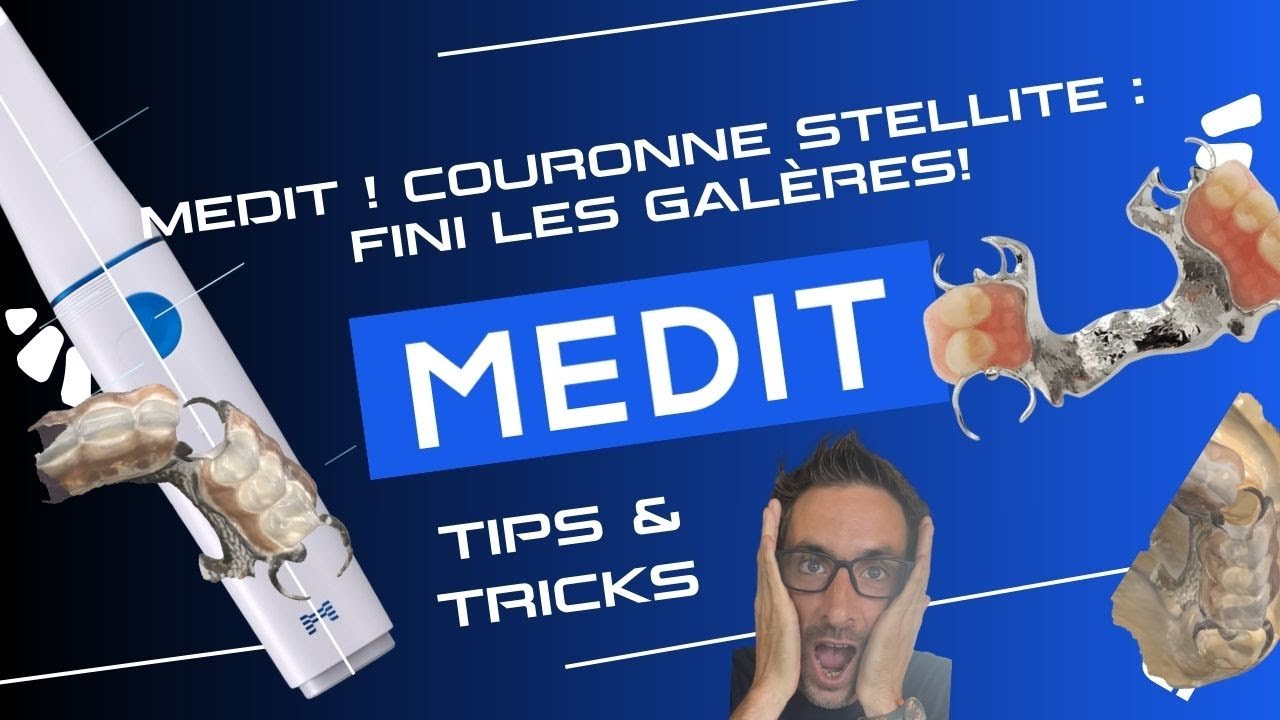 Medit ! Couronne Stellite : Fini les galères!