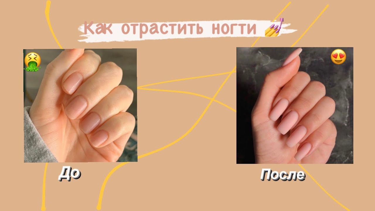КАК ОТРАСТИТЬ НОГТИ за неделю?🧝‍♀️| крепкие и длинные ногти в домашних условиях)