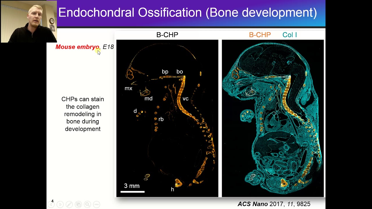 3Helix - Skeletal Imaging with Collagen Hybridizing Peptides