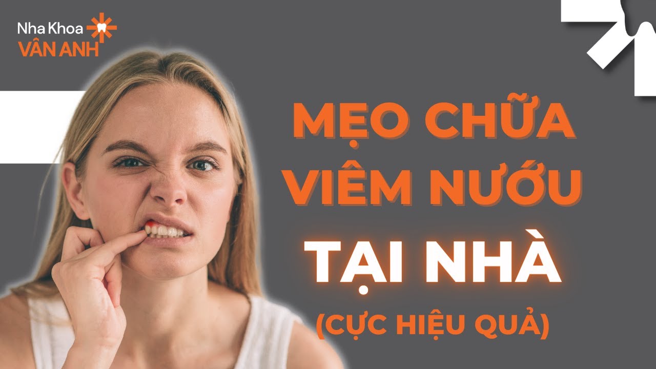 MẸO CHỮA BỊ VIÊM NƯỚU TẠI NHÀ! (CỰC HIỆU QUẢ)