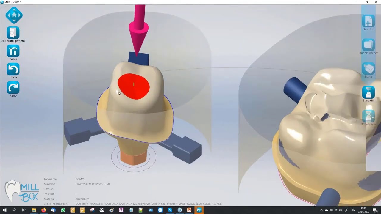 MillBox: Introduction to Dental CAM Software