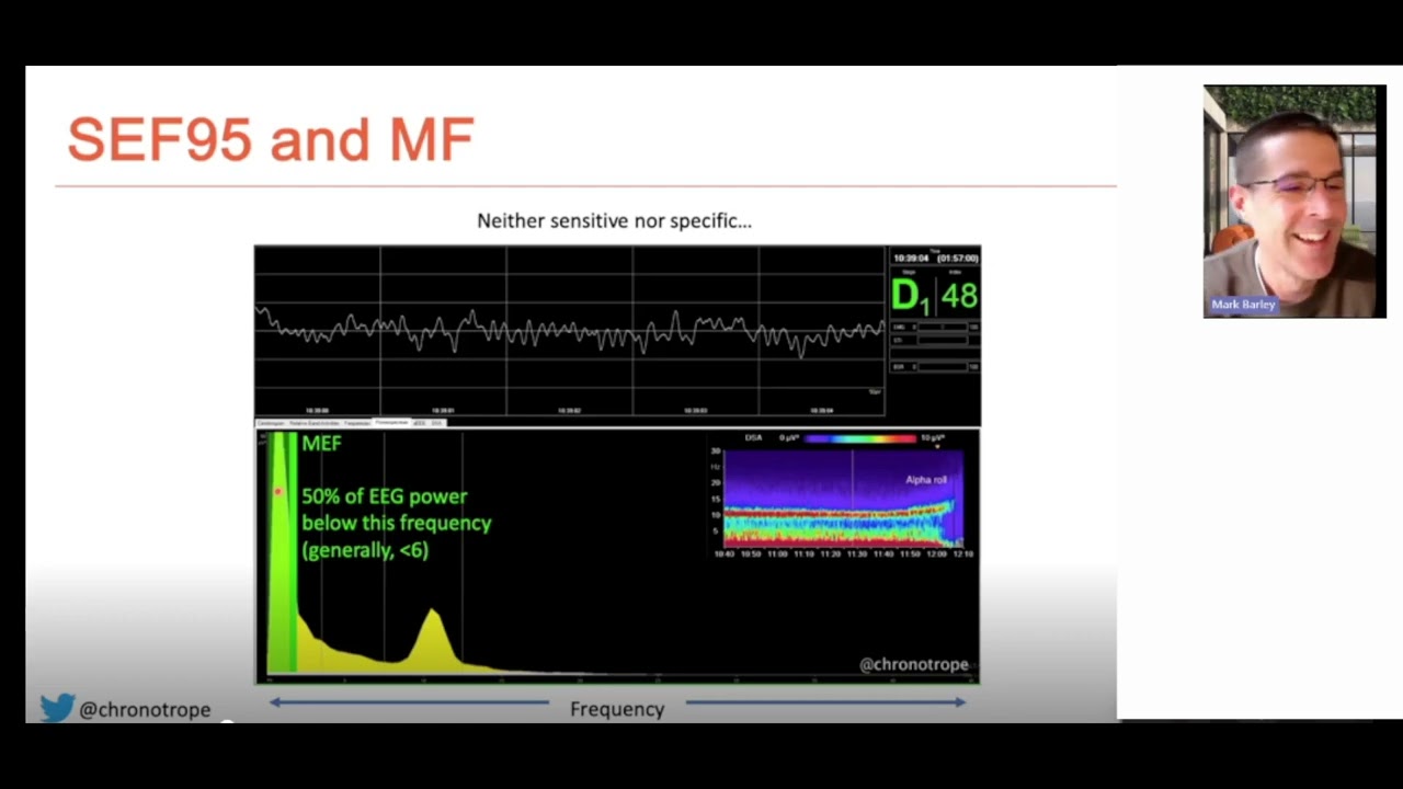 Processed EEG in anaesthesia