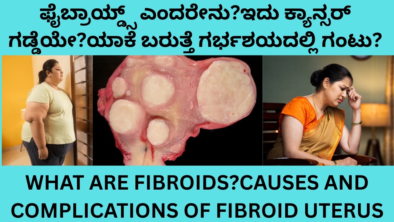 FIBROID UTERUS.CAUSES SYMPTOMS COMPLICATIONS  AND TREATMENT IN KANNADA .ಗರ್ಭಕೋಶದ ಗಡ್ಡೆ