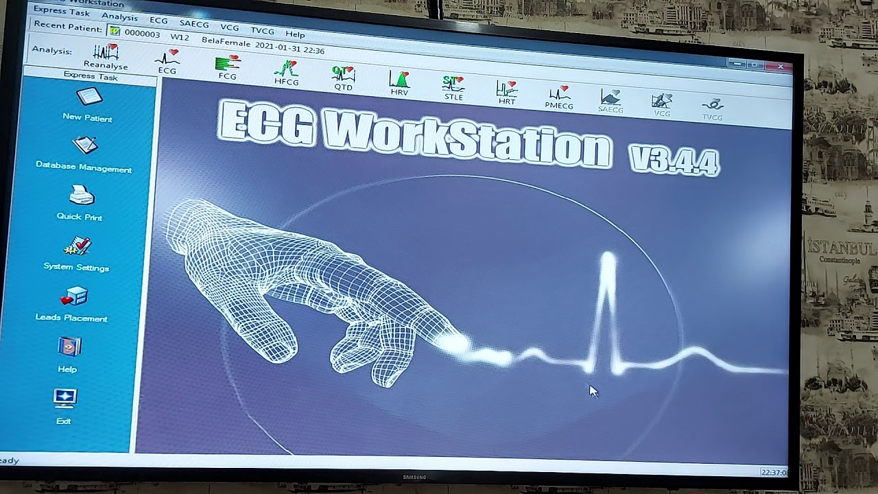 CONTEC 8000G (Part 3) software ECG Work Station
