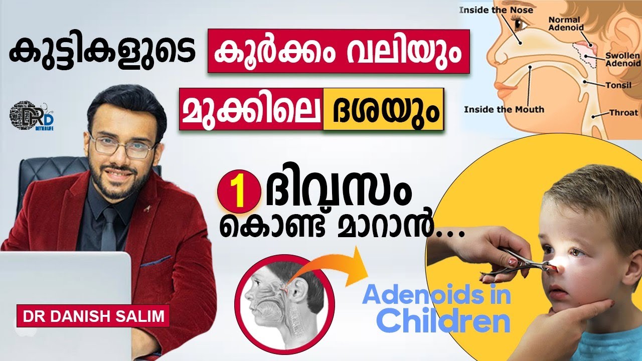 1287: 👶 കുട്ടികൾ കൂർക്കം വലിക്കുന്നത് എന്തുകൊണ്ട് ? കുട്ടികളിൽ മൂക്കിൽ വരുന്ന ദശ എങ്ങനെ മാറ്റാം?
