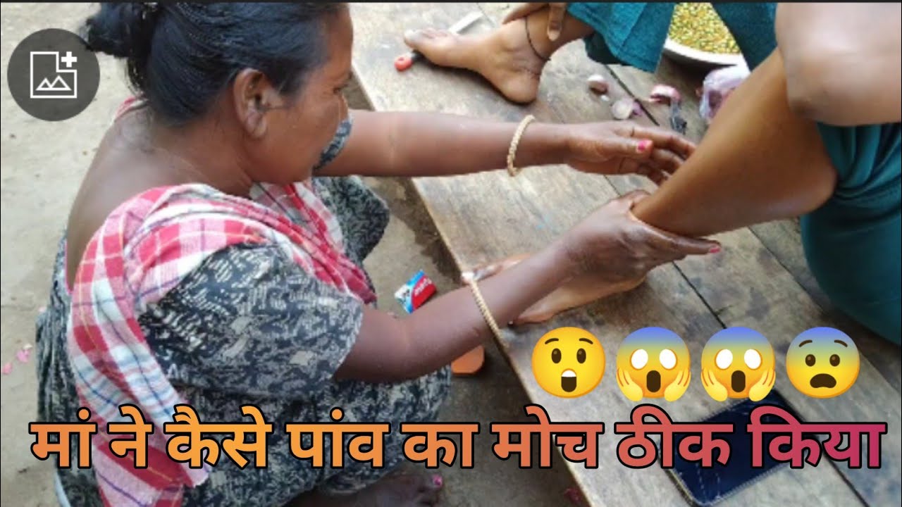 😲😱पैर का मोच को मां ने दो मिनट में ठीक कर दिया 😱😲 देसी तरीका से Sameer blog video