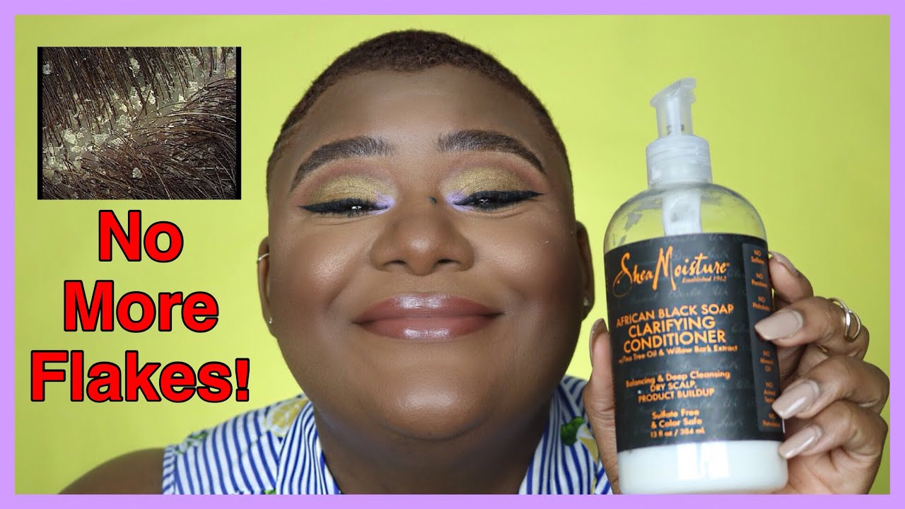 Get rid of that crusty scalp, girl!! :: Seborrheic Dermatitis, Dandruff, and Dry Scalp on 4C Hair