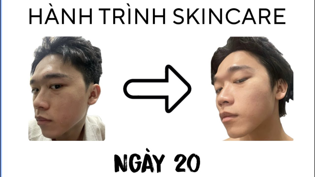 Chăm skincare hằng ngày và kết quả là... | Ngày 20 - Cách kiếm tiền nhanh nhất là gì?