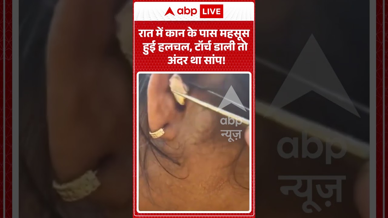 Viral Video : रात में कान के पास महसूस हुई हलचल, टॉर्च डाली तो अंदर था सांप! | #viral #ytshorts