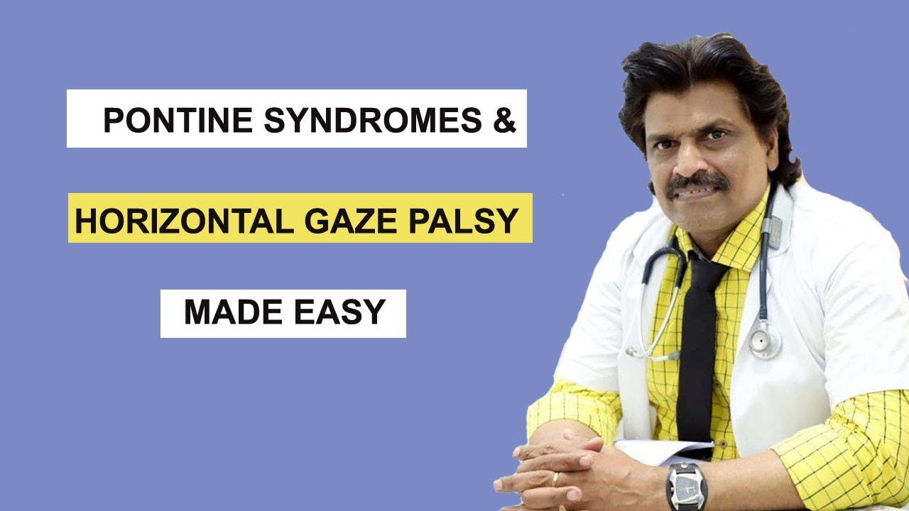PONTINE SYNDROMES & HORIZONTAL GAZE PALSY MADE EASY