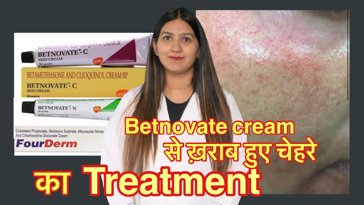 Побочные эффекты стероидных кремов Betnovate C | Лечение покраснения лица.