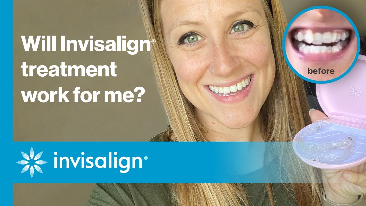 Подойдет ли мне лечение Invisalign®? | Invisalign