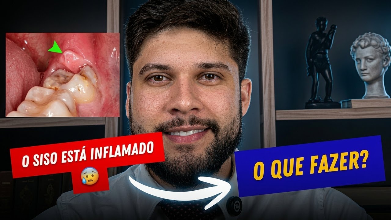 SISO INFLAMADO E AGORA? | RESOLVER EM CASA?