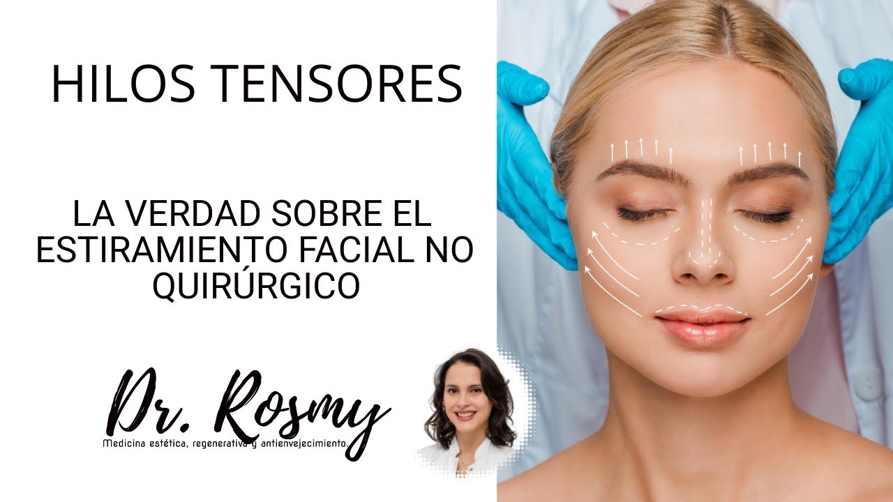 HILOS TENSORES - Todo lo que quieres saber - Estiramiento facial no quirúrgico