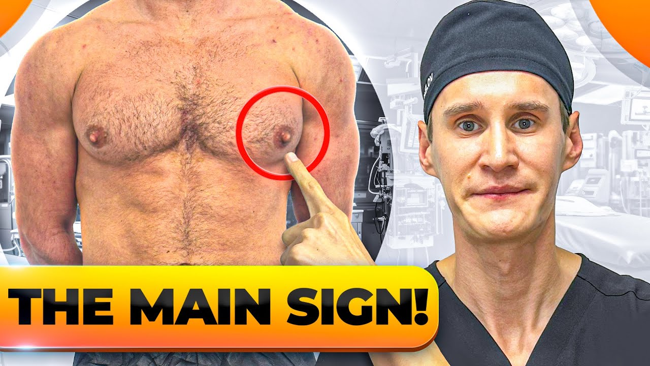 Do You Really Have Gynecomastia? (Home Test)