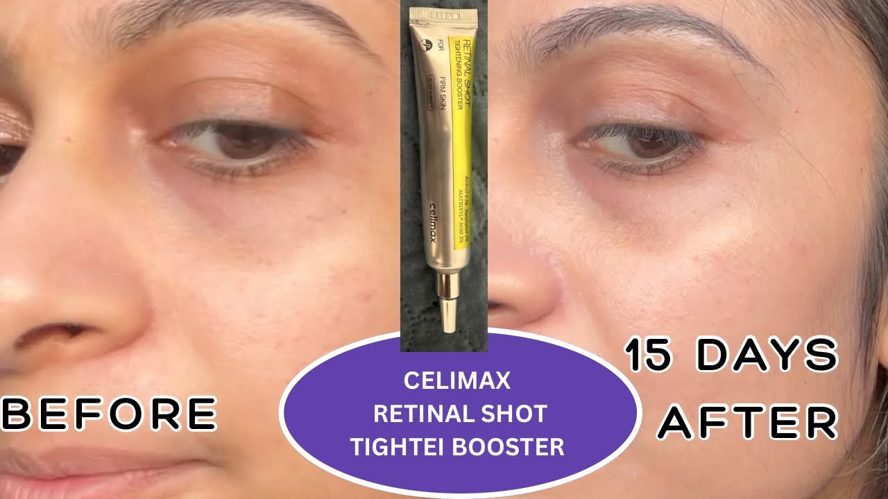 Celimax Retinal Shot for Beginners: Real Results + Pros & Cons and tips 