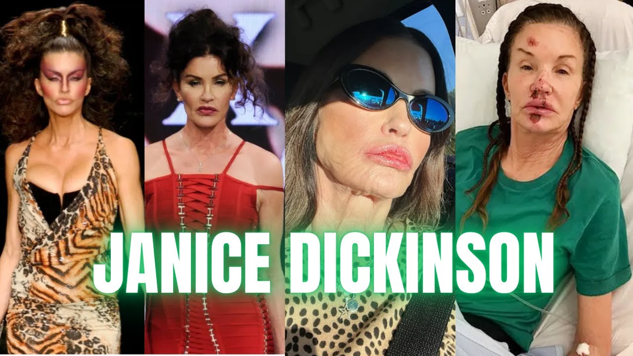 The SHATTERED life of Janice Dickinson