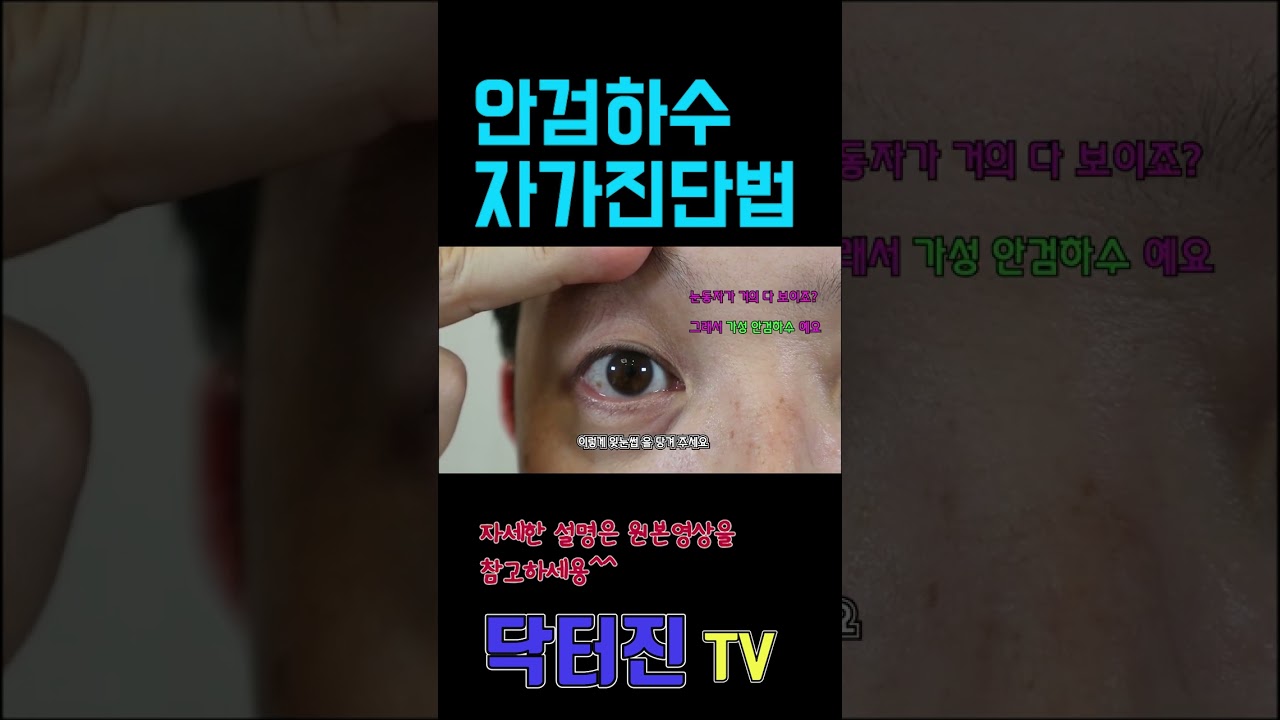 나는 안검하수일까? 안검하수 자가진단법! #shorts